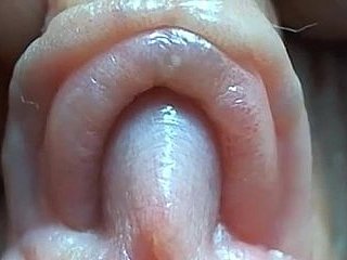 Clit rất gần lên