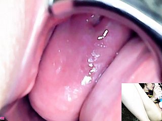 adalynnx- 내시경 검경 Hitachi Vibrator Cum