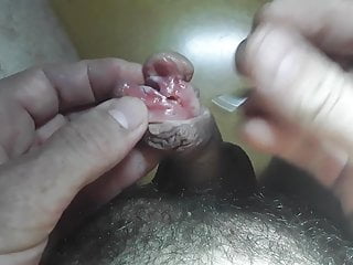 ثقب وsubincision